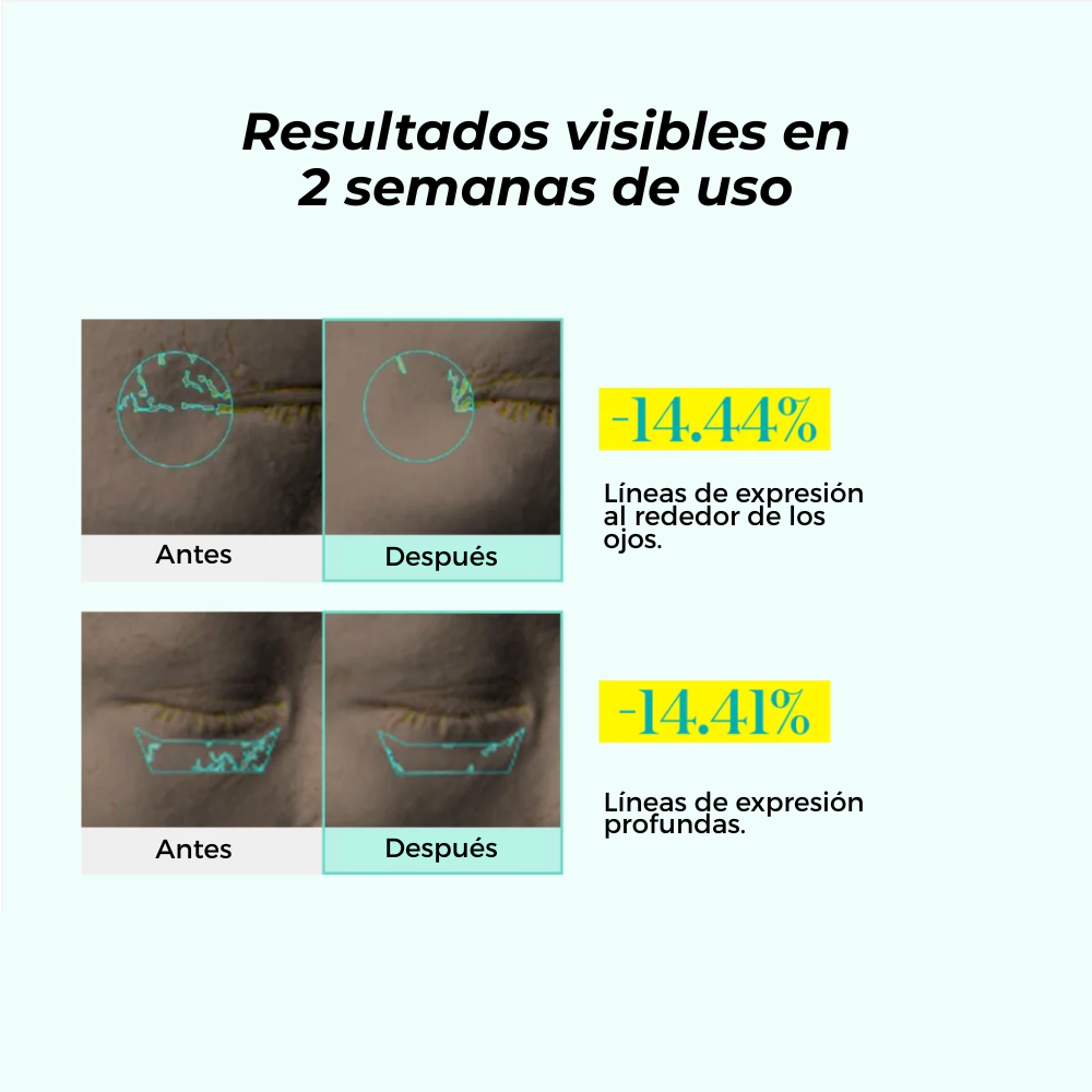 PDRN Reedle Shot Firming Eye Lifter