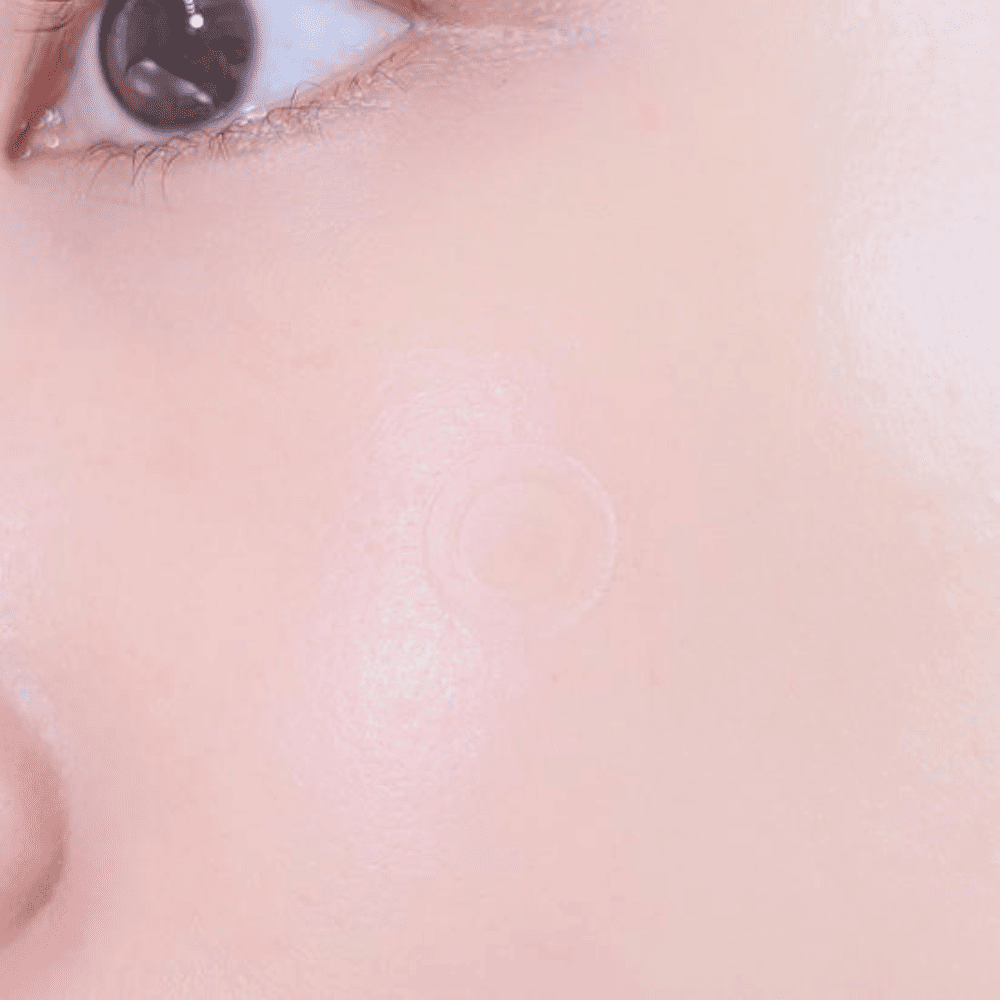 Care Plus Spot Patch (parches para acné)