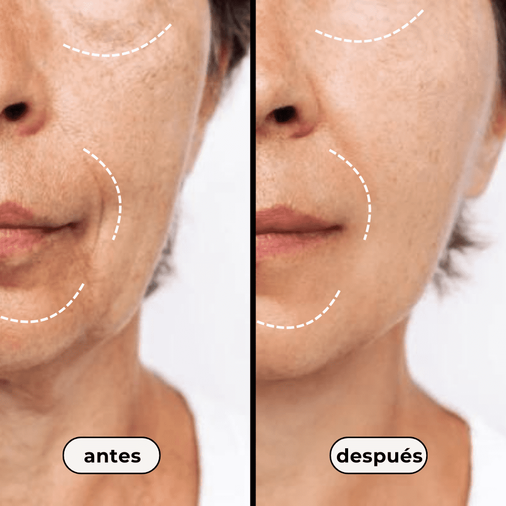 Kit anti-edad (Lifting facial)