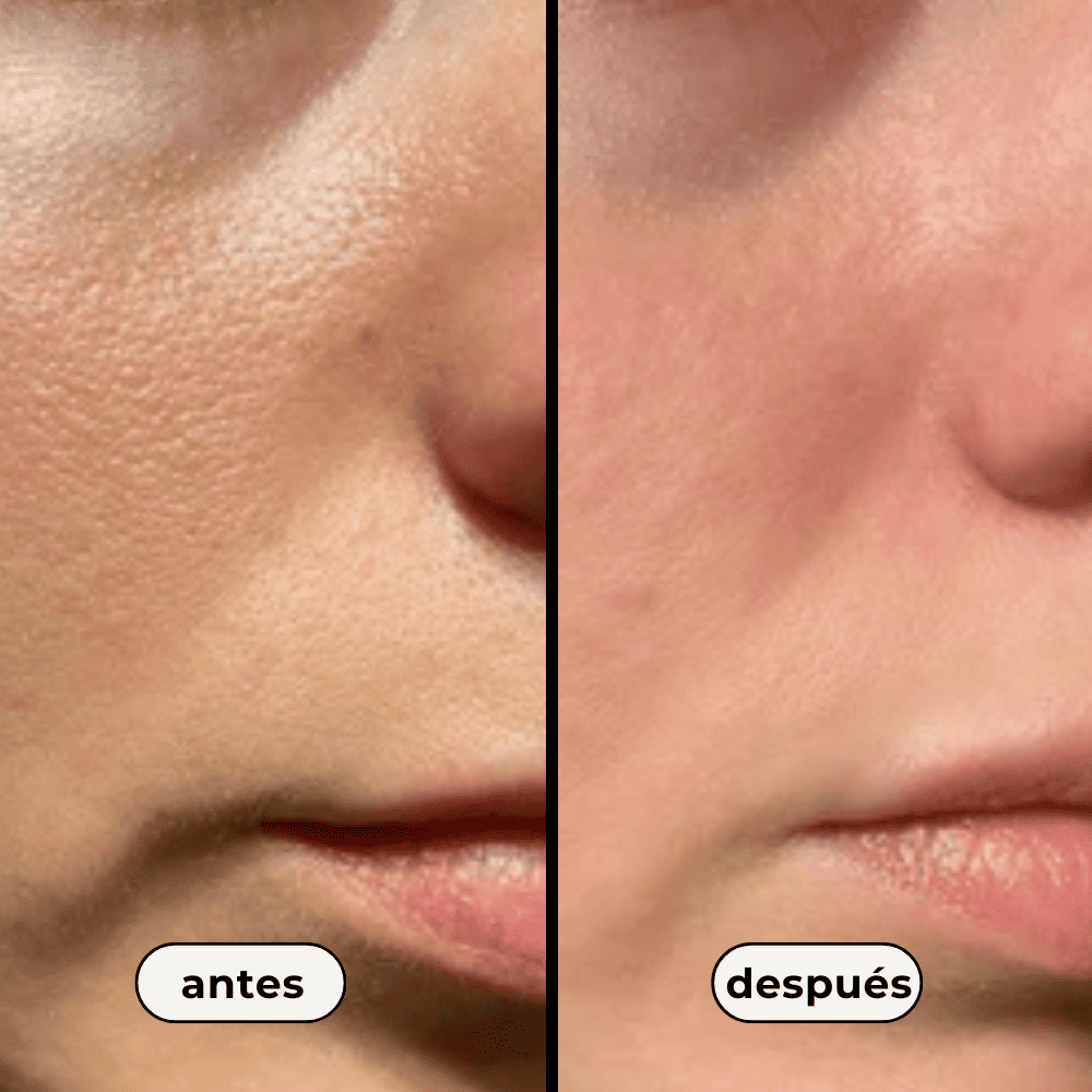 No.4 Pore Zero Toner Pad (poros dilatados)
