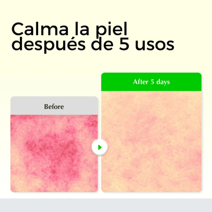 Aloe PDRN Calming Serum
