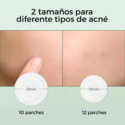 Tea-Trica Spot Cover Patch