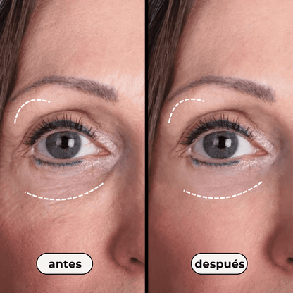 Anti Wrinkle Eye Cream: Adenosina + Líneas de expresión